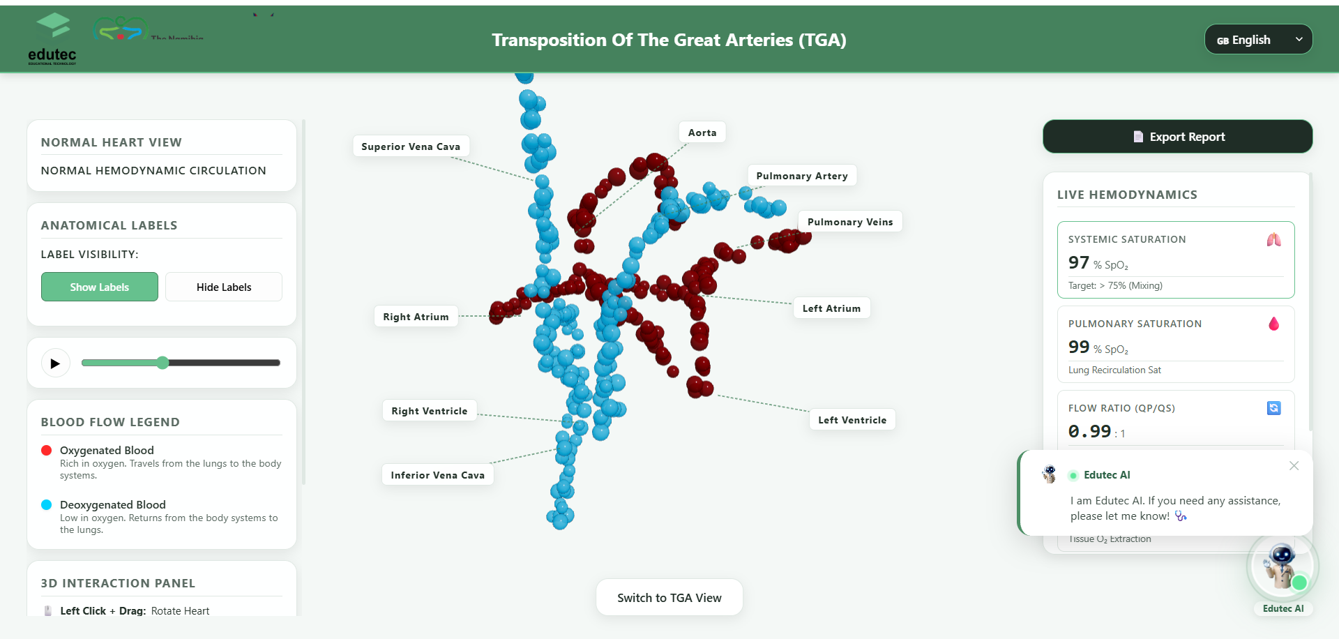 Transposition of the Great Arteries Simulation