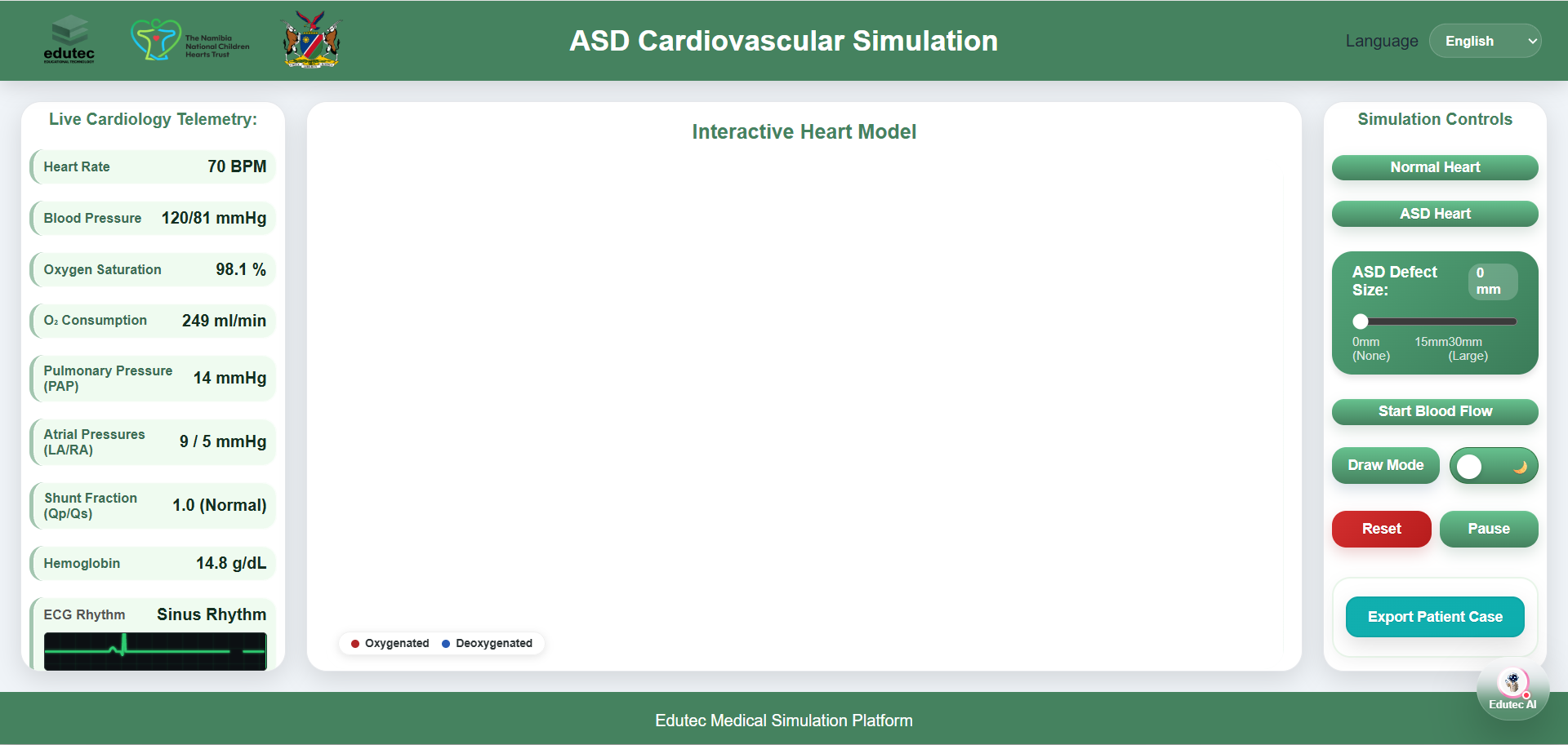 ASD Cardiovascular Simulation